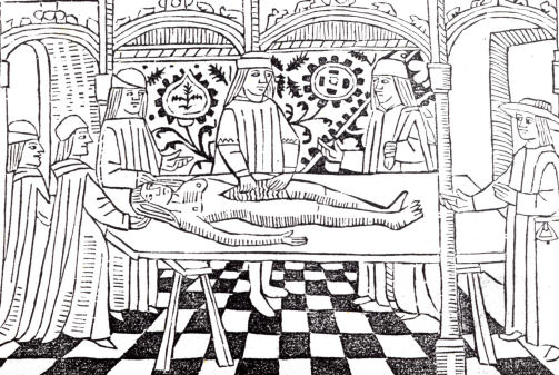 Le�on d'anatomie au 15� si�cle, Toulouse, Henri Mayer, 1494