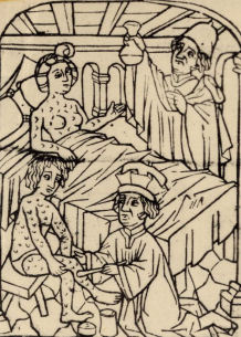 Mal de Fracastor&nbsp;: Frontispice de Barth&eacute;l&eacute;miy Steber